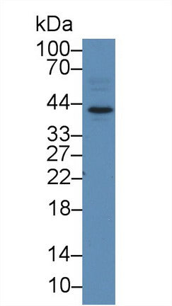 Polyclonal Antibody to Hepatoma Derived Growth Factor (HDGF)