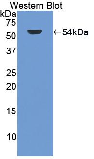 Polyclonal Antibody to Glycogen Synthase Kinase 3 Alpha (GSK3a)