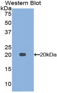 Polyclonal Antibody to Midkine (MK)