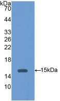 Polyclonal Antibody to Hexosaminidase B Beta (HEXb)