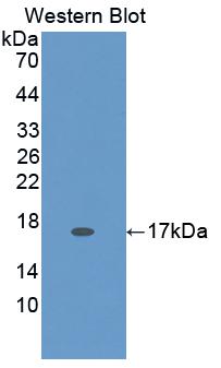 Polyclonal Antibody to Hexosaminidase B Beta (HEXb)