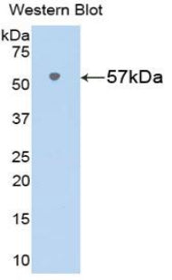 Polyclonal Antibody to Visfatin (VF)