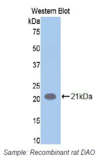 Polyclonal Antibody to Amiloride Binding Protein 1 (ABP1)