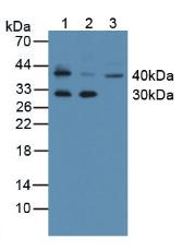 Polyclonal Antibody to Kallikrein 11 (KLK11)