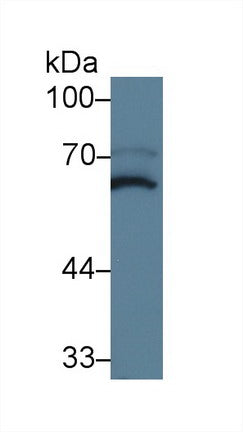 Polyclonal Antibody to Membrane Protein, Palmitoylated 2 (MPP2)