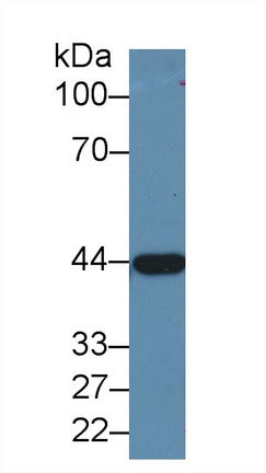 Polyclonal Antibody to Alcohol Dehydrogenase 1 (ADH1)