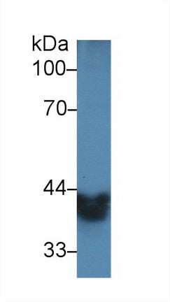 Polyclonal Antibody to Alcohol Dehydrogenase 1 (ADH1)