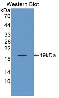 Polyclonal Antibody to Mucin 5 Subtype B (MUC5B)