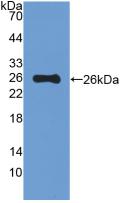 Polyclonal Antibody to Mucin 5 Subtype B (MUC5B)