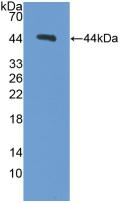 Polyclonal Antibody to Procalcitonin (PCT)