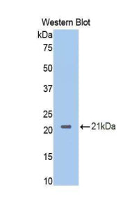 Polyclonal Antibody to Neuropilin 1 (NRP1)