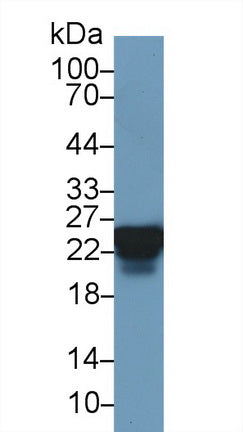 Polyclonal Antibody to Heat Shock Protein 27 (Hsp27)