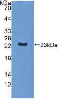 Polyclonal Antibody to Membrane Protein, Palmitoylated 6 (MPP6)