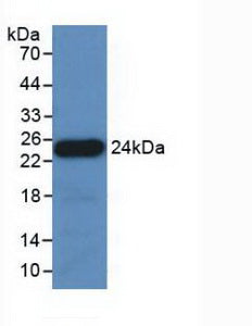 Polyclonal Antibody to Apolipoprotein E (APOE)