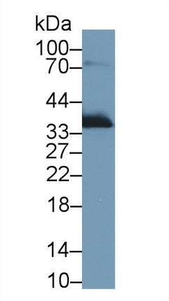 Polyclonal Antibody to Apolipoprotein E (APOE)