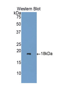 Polyclonal Antibody to Heparanase (HPSE)