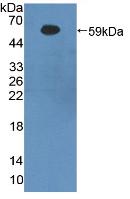 Polyclonal Antibody to Beta-Site APP Cleaving Enzyme 1 (bACE1)