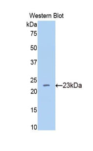 Polyclonal Antibody to Beta-Site APP Cleaving Enzyme 1 (bACE1)