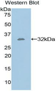 Polyclonal Antibody to Glucose 6 Phosphate Isomerase (GPI)