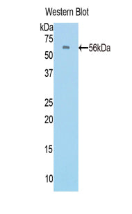 Polyclonal Antibody to Protein C (PROC)