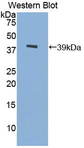 Polyclonal Antibody to Metallothionein 3 (MT3)