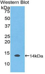 Polyclonal Antibody to Mucin 5 Subtype AC (MUC5AC)