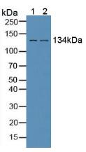 Polyclonal Antibody to Epidermal Growth Factor Receptor (EGFR)