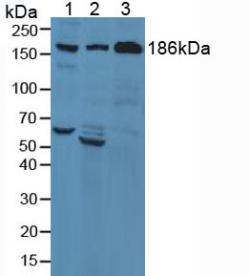 Polyclonal Antibody to Complement C3 Convertase (C3 Convertase)