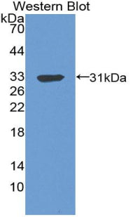 Polyclonal Antibody to C4 Binding Protein Beta (C4BPb)