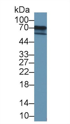Polyclonal Antibody to Forkhead Box Protein C1 (FOXC1)
