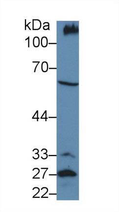 Polyclonal Antibody to Podocalyxin (PODXL)