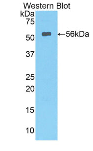 Polyclonal Antibody to Lipase, Hepatic (LIPC)