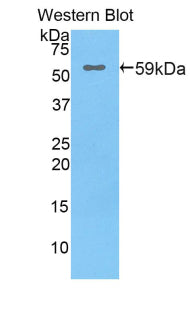 Polyclonal Antibody to Lipase, Hepatic (LIPC)