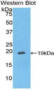 Polyclonal Antibody to Chemokine C-X-C-Motif Ligand 16 (CXCL16)