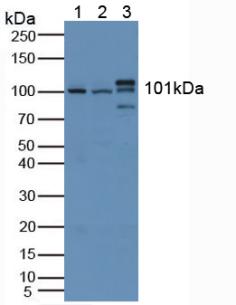 Polyclonal Antibody to Hexokinase 1 (HK1)