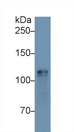 Polyclonal Antibody to Hexokinase 1 (HK1)