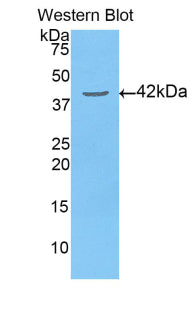 Polyclonal Antibody to Pyruvate dehydrogenase alpha 1 (PDHA1)