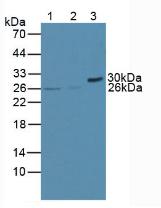 Polyclonal Antibody to B-Cell Leukemia/Lymphoma 2 (Bcl2)