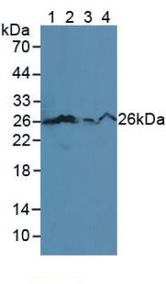 Polyclonal Antibody to B-Cell Leukemia/Lymphoma 2 (Bcl2)