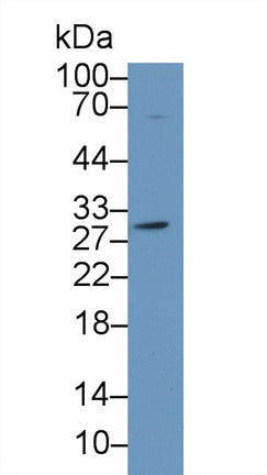 Polyclonal Antibody to Carbonic Anhydrase II (CA2)