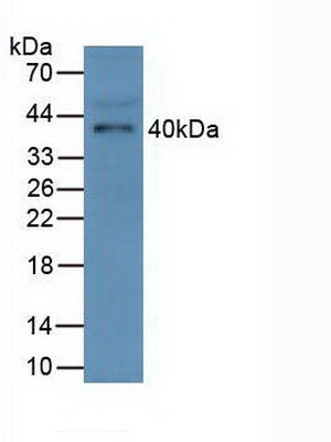 Polyclonal Antibody to Ficolin 1 (FCN1)