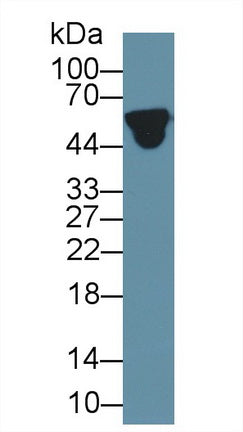 Polyclonal Antibody to Alpha-1-Acid Glycoprotein (a1AGP)