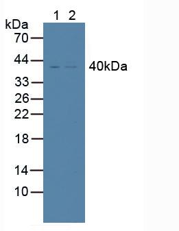 Polyclonal Antibody to Death receptor 5 (DR5)