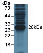 Polyclonal Antibody to Parathyroid Hormone Related Protein (PTHrP)