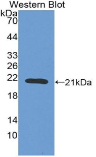 Polyclonal Antibody to Coagulation Factor II (F2)