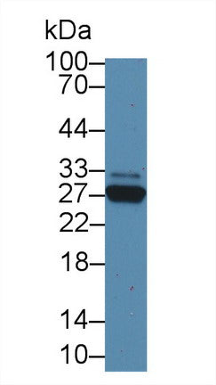 Polyclonal Antibody to C Reactive Protein (CRP)