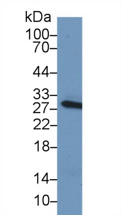 Polyclonal Antibody to C Reactive Protein (CRP)