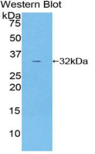 Polyclonal Antibody to Heat Shock Protein 90kDa Beta 1 (HSP90b1)