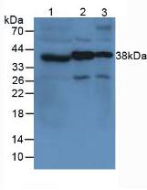 Polyclonal Antibody to Von Willebrand Factor (vWF)