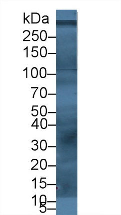 Polyclonal Antibody to Von Willebrand Factor (vWF)